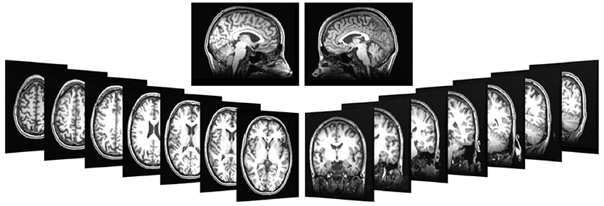 MRI images of an adult female brain from a 3Tesla scanner