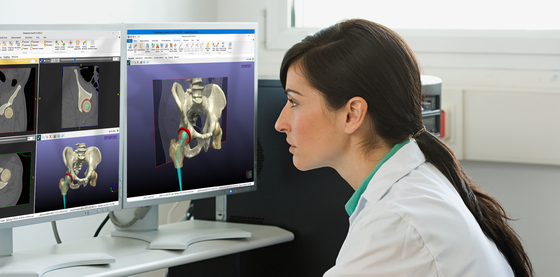 Woman doing medical image processing in Simpleware software