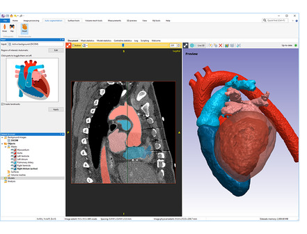3D & 4D Image Processing for Life Sciences with Machine Learning | Synopsys