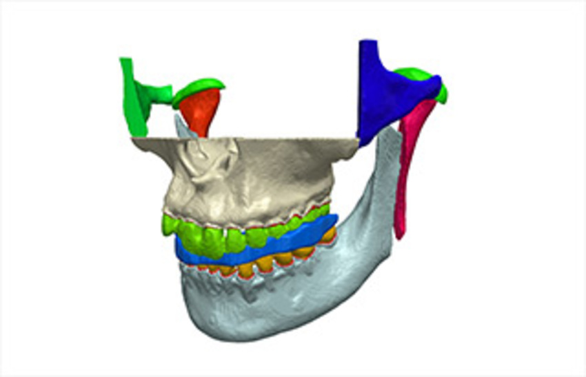 3D model of the jaw in Simpleware ScanIP including the periodontal ligament
