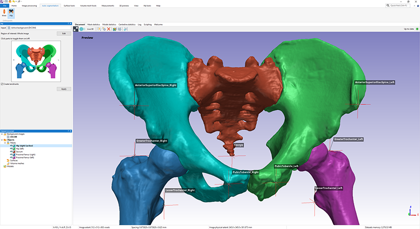 ortho extract software ortho extract software