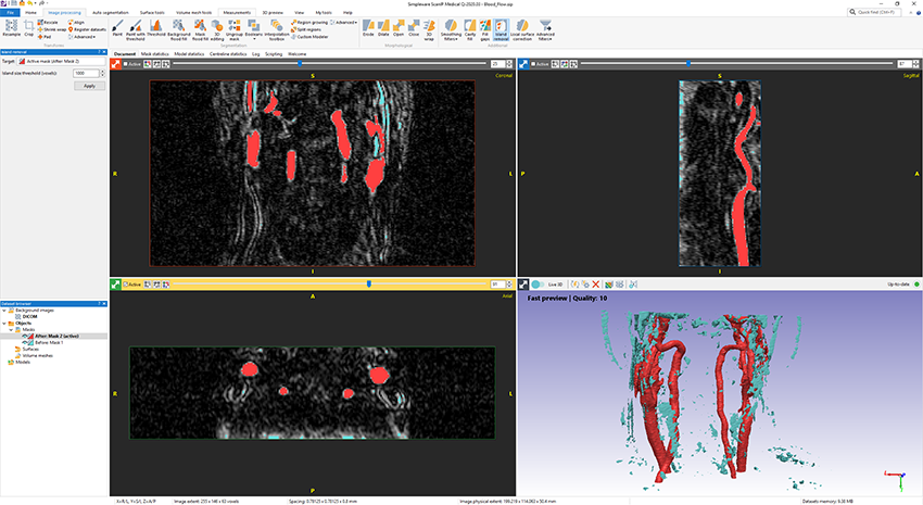 cam350 remove samll islands cam350 remove samll islands