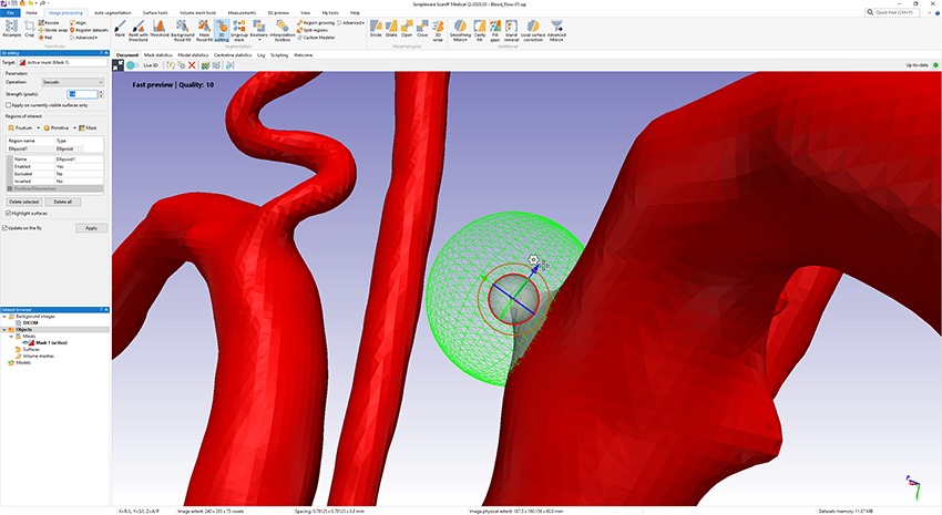 Advanced 3D editing tools in Simpleware ScanIP