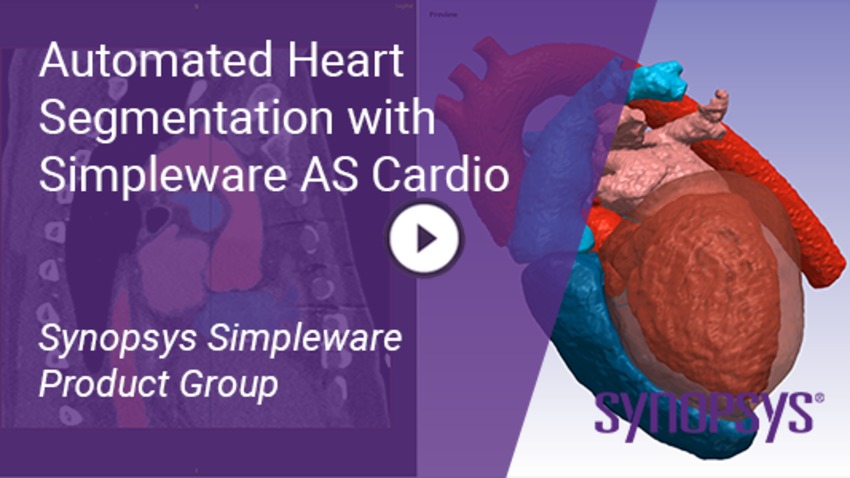Automated Heart Segmentation by Simpleware | Synopsys 