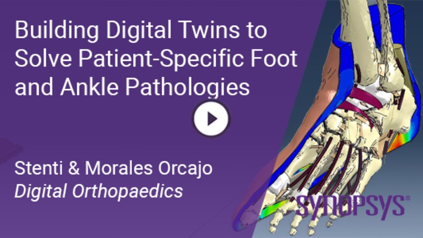 Building Digital Twims to Solve Patient-Specific Foot & Ankle Pathologies by Simpleware | Synopsys 