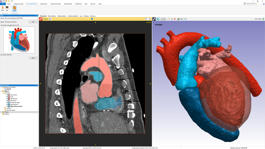 Simpleware AS Cardio heart segmentation tool and output