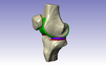 Example segmentation of bone anatomy in Simpleware software