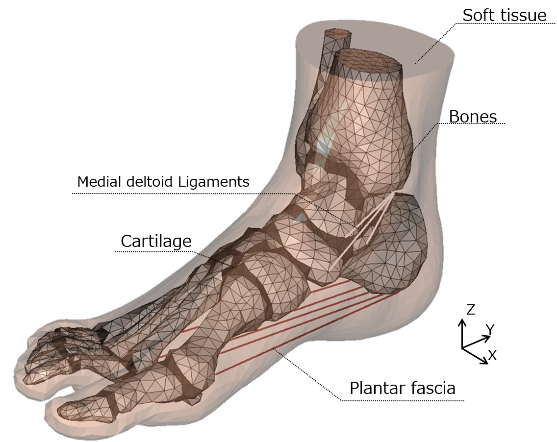 3D numerical foot model